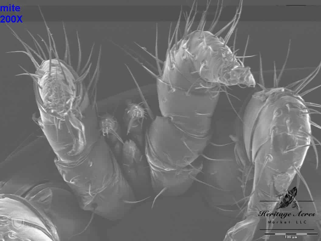 Varroa mite 200x magnification