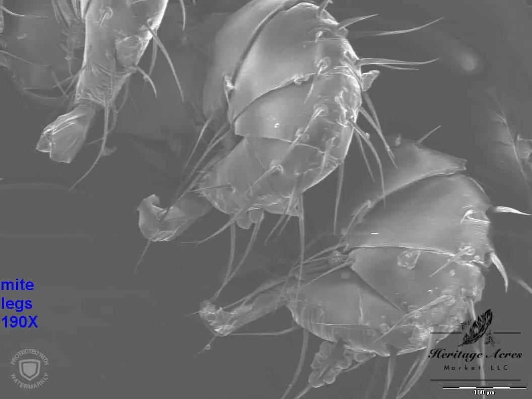 Varroa mite legs 150x magnification