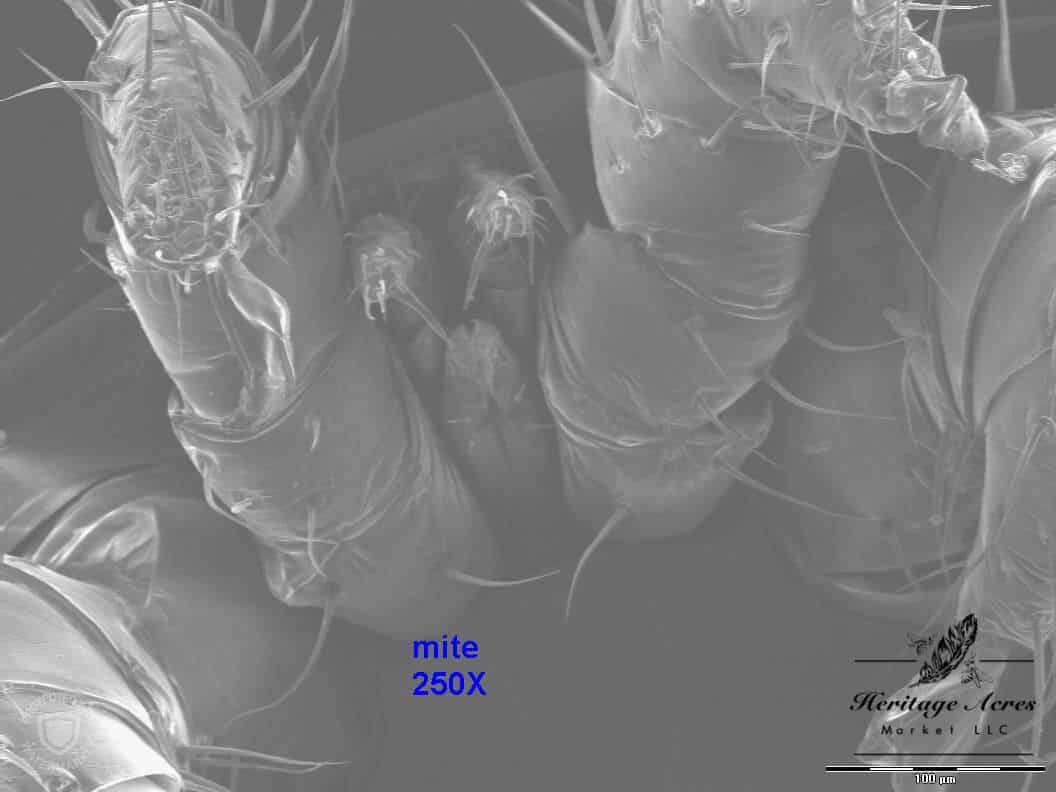 Varroa mite 250x magnification